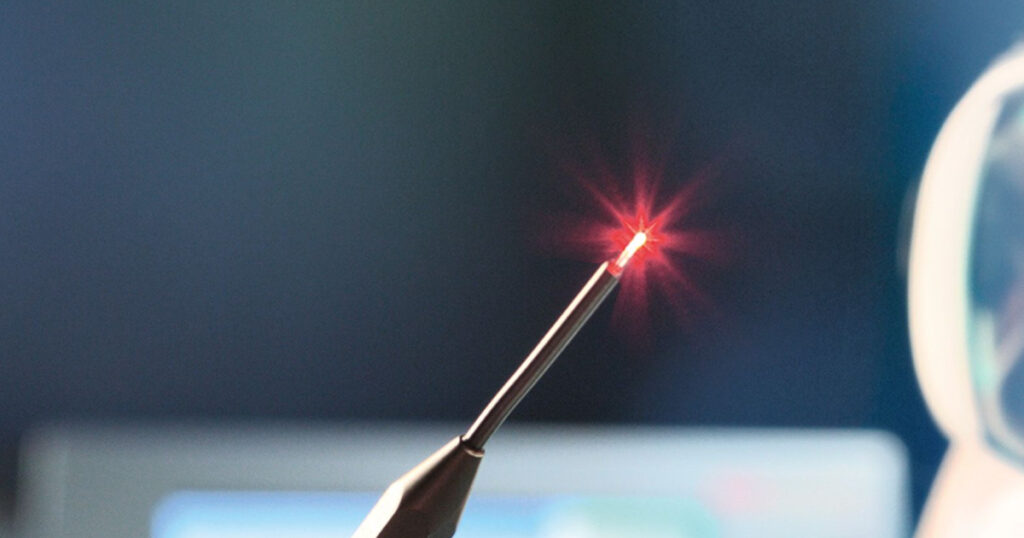 Sünnet Yöntemleri Nelerdir?