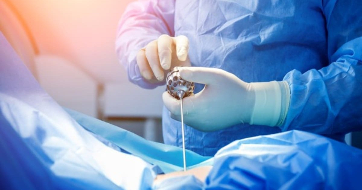 Çocuklarda Kasık Fıtığı Ameliyatı