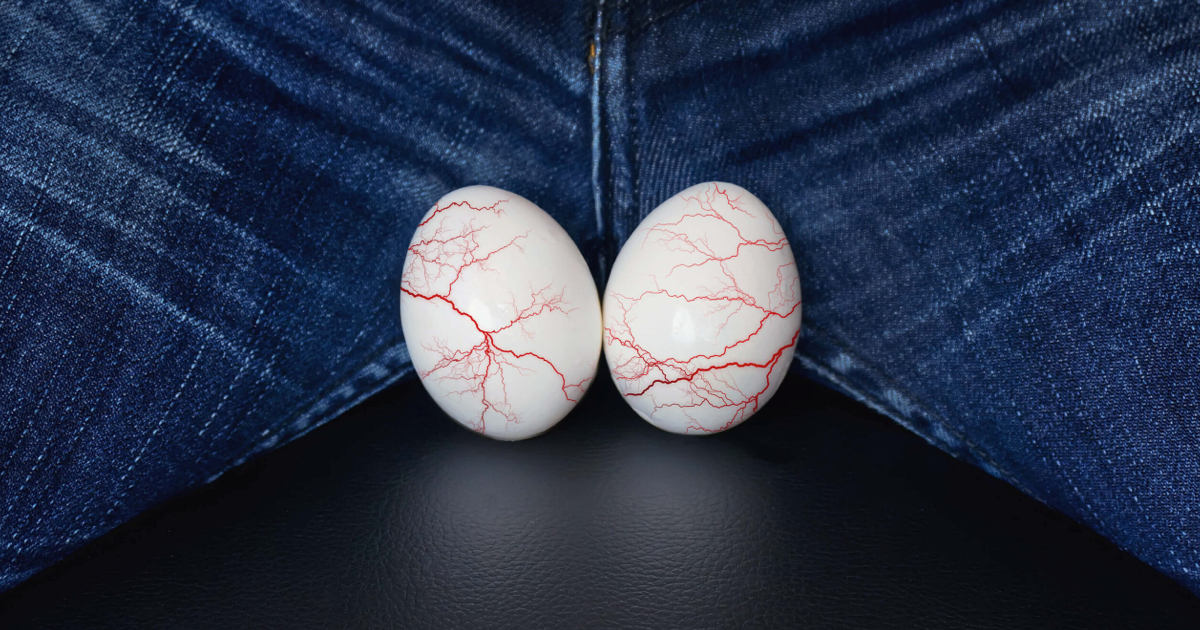 Varikosel Nedir, Çocuklarda Görülür mü?